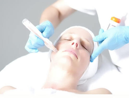 Microneedling